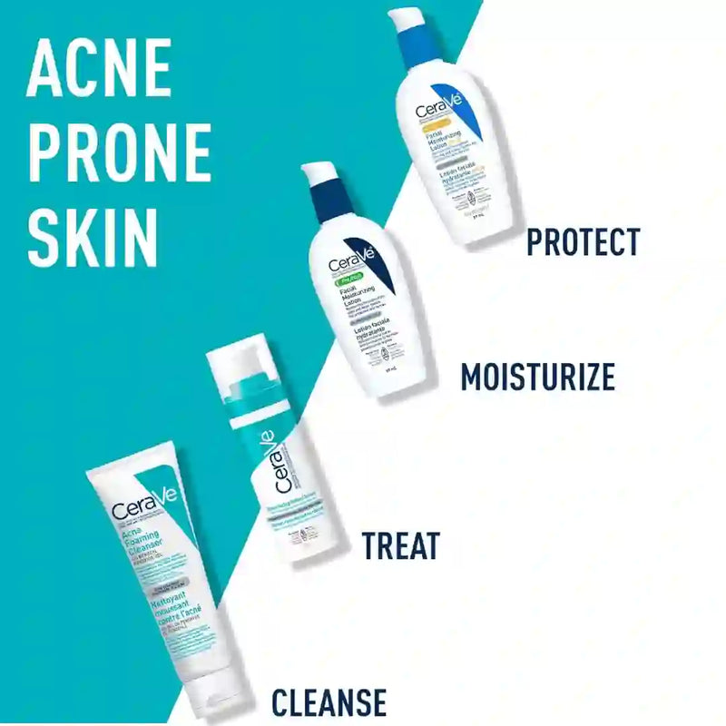 Acne Foaming Cleanser 4% Benzoyl Peroxide