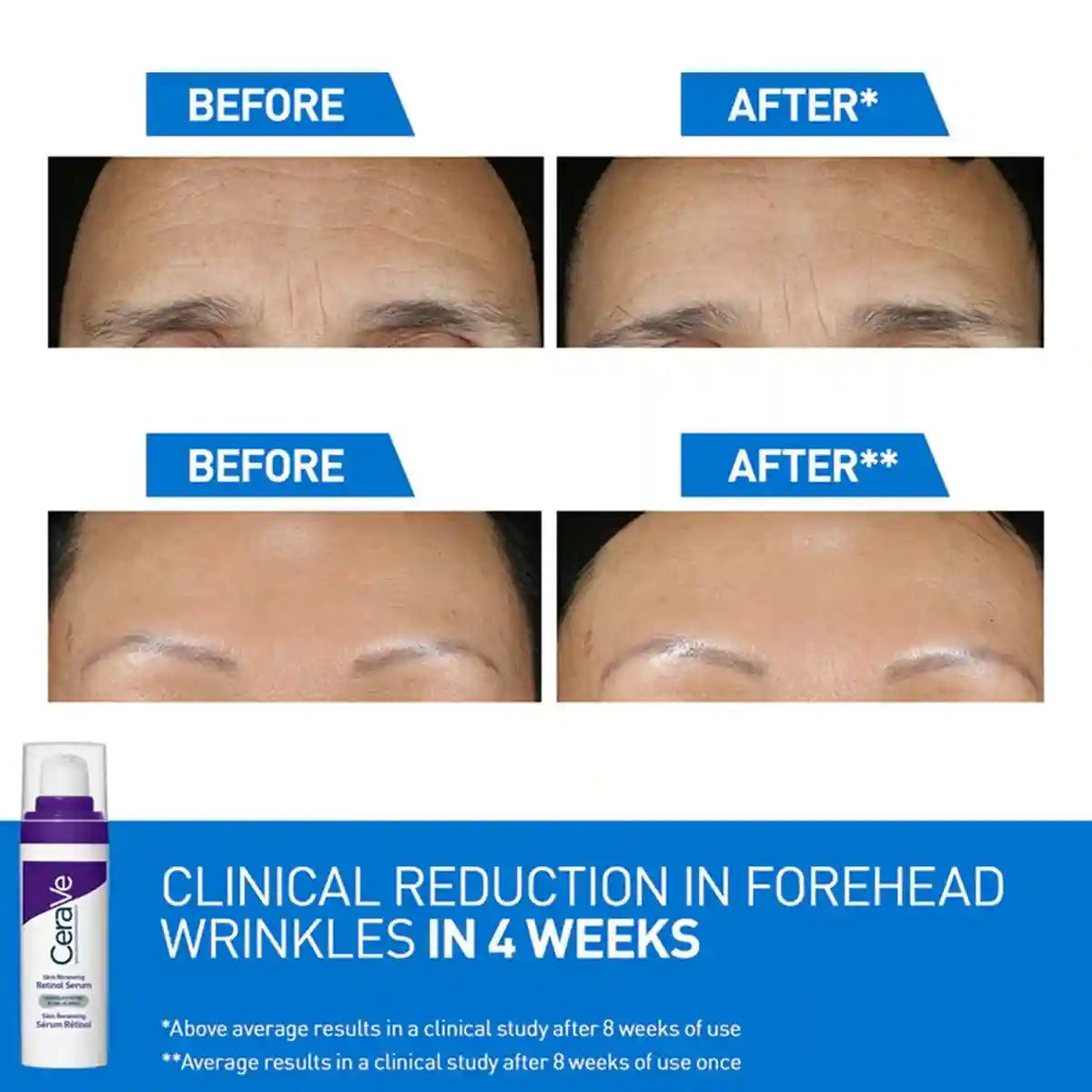 Skin Renewing Retinol Serum
